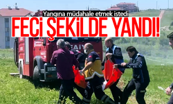 Yangına müdahale etmek isterken feci şekilde yandı