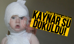 Küçük kızın yüzüne sıcak su döküldü!