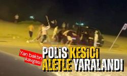 'Yan baktın' kavgasında polis kesici aletle yaralandı!
