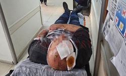 Merdivenden düşen şahıs yaralandı