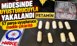 Midesinde uyuşturucuyla yakalandı!
