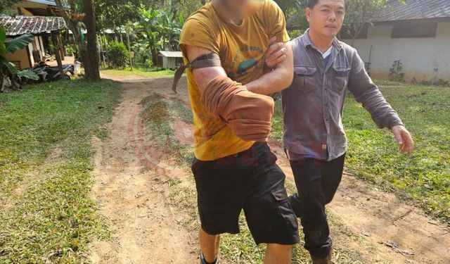 Ayı saldırısından kurtulmak için kendi kolunu kesti