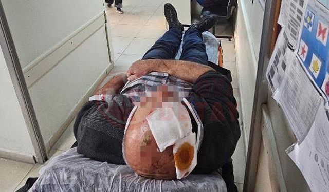 Merdivenden düşen şahıs yaralandı