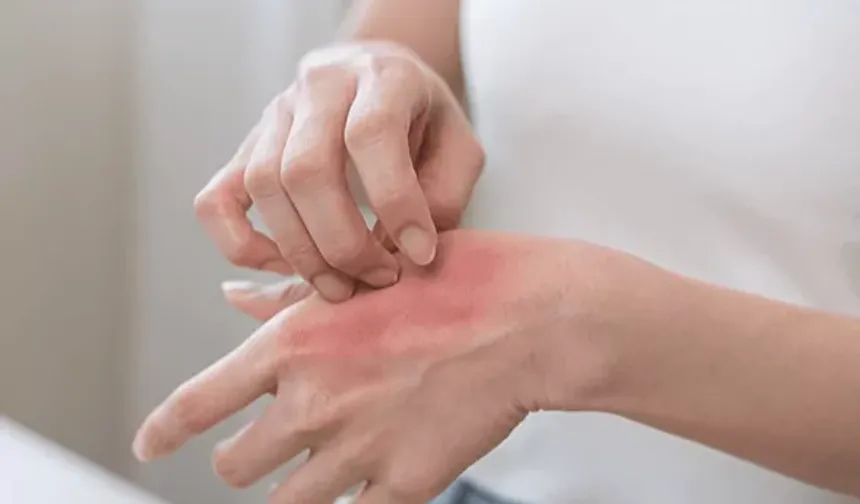 Kaşıntı yalnızca bir cilt sorunu olarak ele alınmamalı!