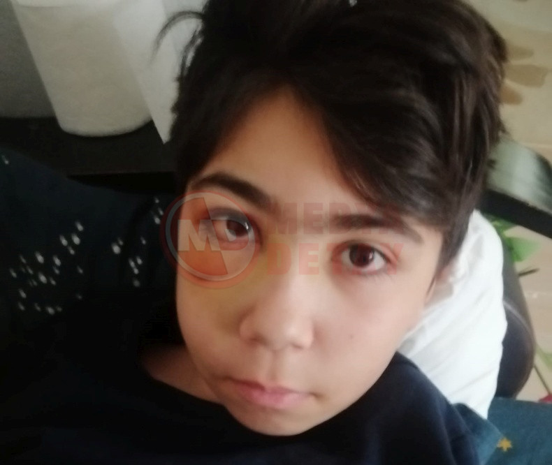 Cocugun Basina Kale Diregi Dustu (4)