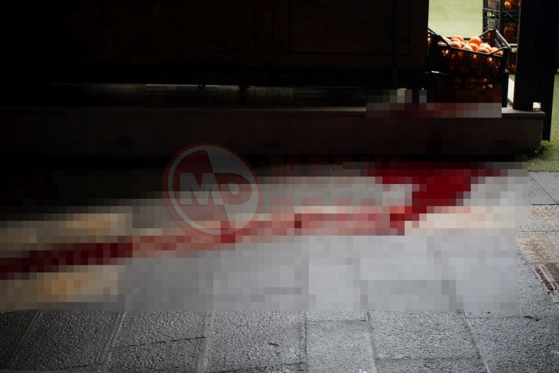 Gogsunden Bicaklanmisti Hayatini Kaybetti (1)