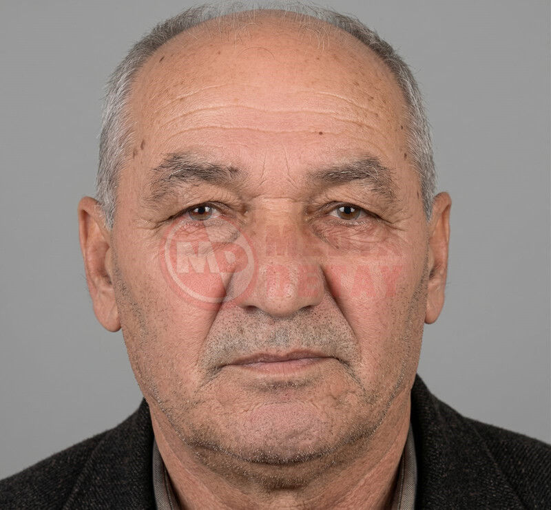 Kayip Adamin Cansiz Bedenine Ulasildi3