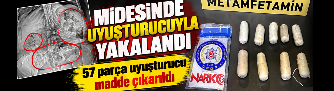 Midesinde uyuşturucuyla yakalandı!